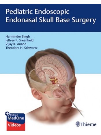Pediatric Endoscopic Endonasal Skull Base Surgery 1st Ed.